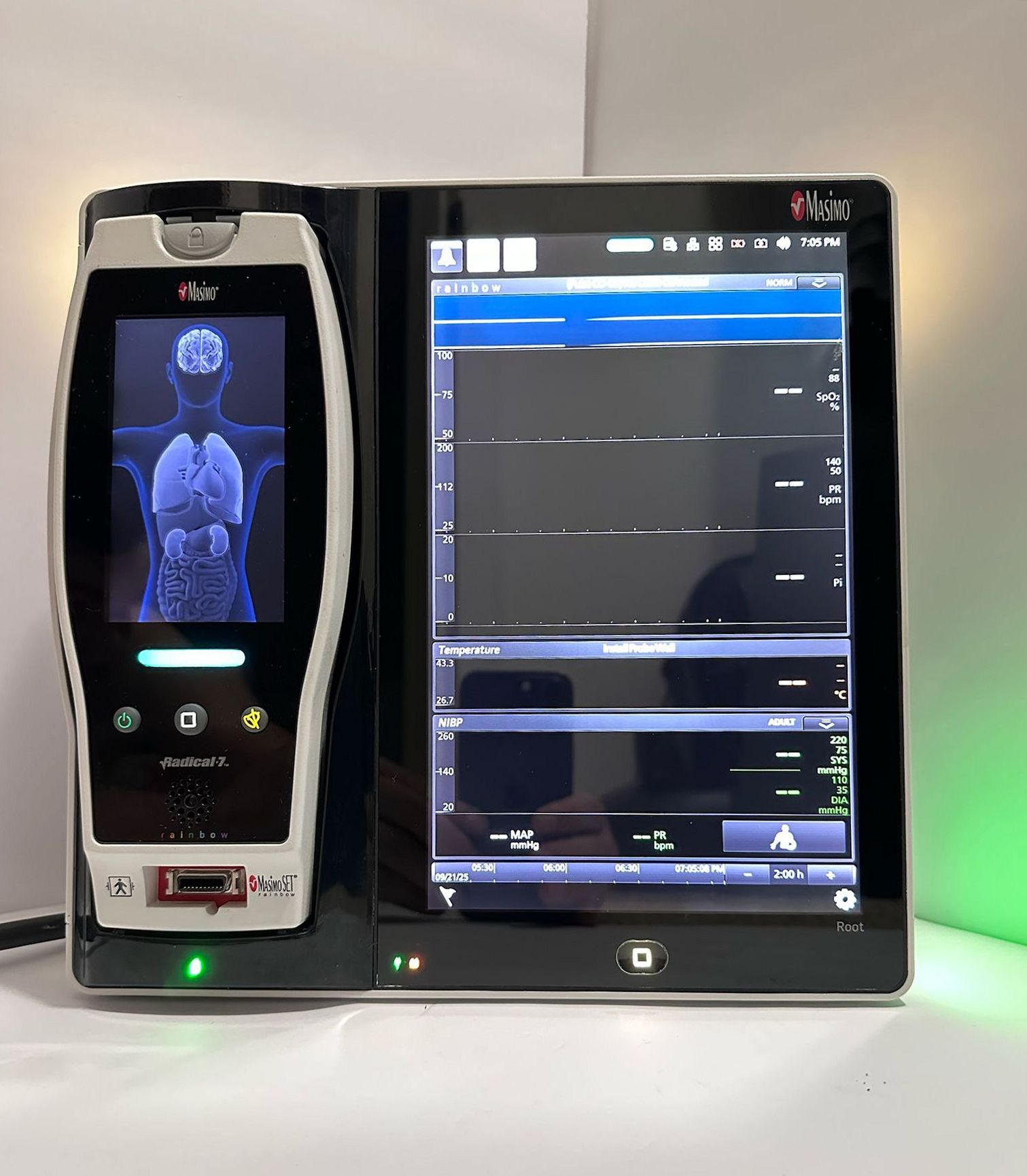 Masimo RDS7A Root Monitor with Masimo Radical 7 Pulse Oximeter - Image 2